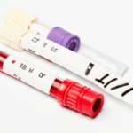 Jak wykonać skuteczny test na HIV?